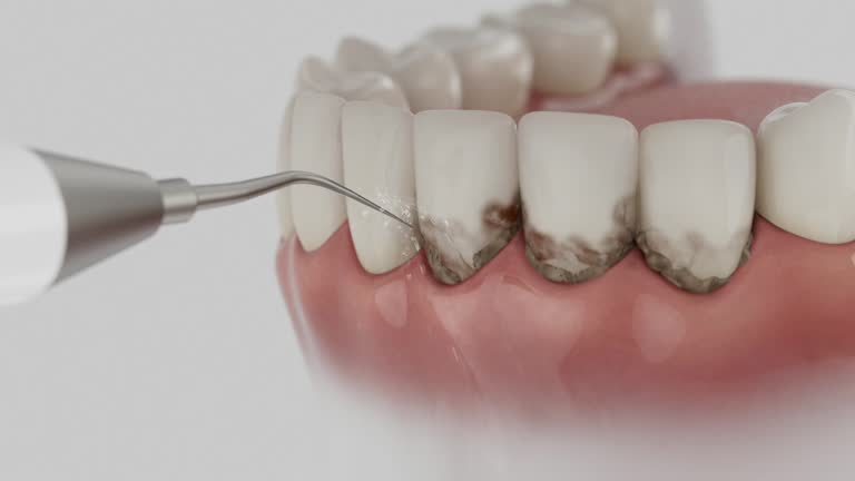 Trusted Dental Implants service in Apalachicola, FL - Dentist Open Now